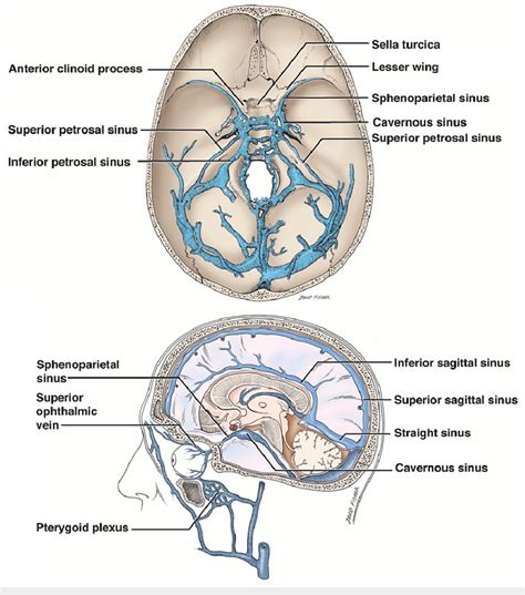 Schematic Drawings Of The Dural Venous Sinuses Of The Skull Base Noting
