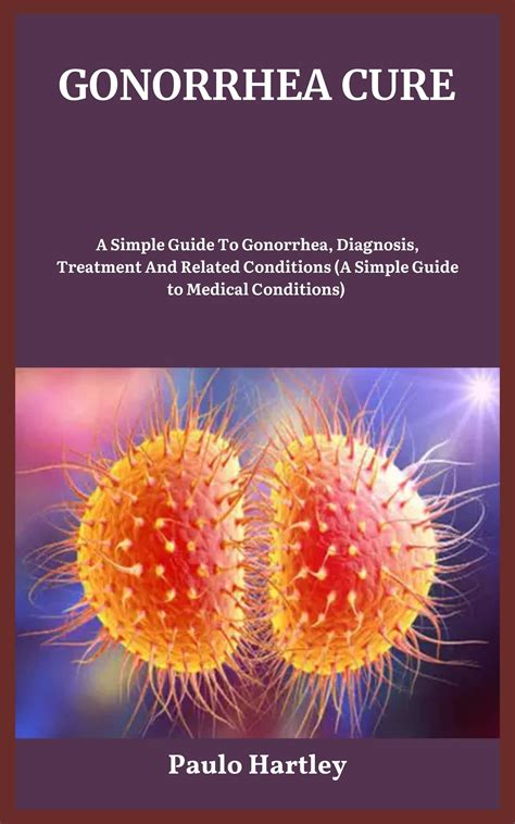 Gonorrhea Cure A Simple Guide To Gonorrhea Diagnosis Treatment And