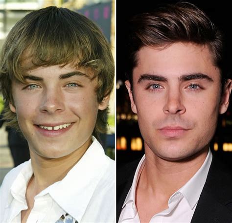Zac Efron Then And Now Celebrities Photo 36463424 Fanpop