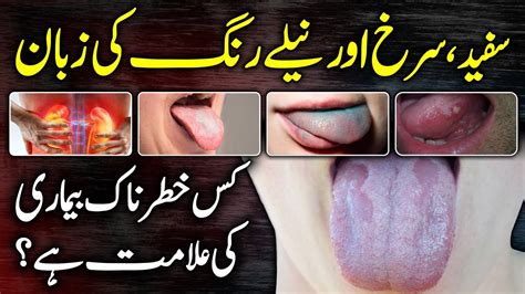 9 Tongue Signs Your Body Is Asking For Help Zuban Sy Apni Bimari Ki Tashkhees Karain Urdu