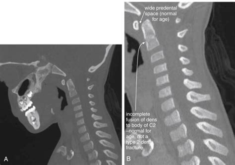 Label The Ct Scan Of The Neck Captions Trendy