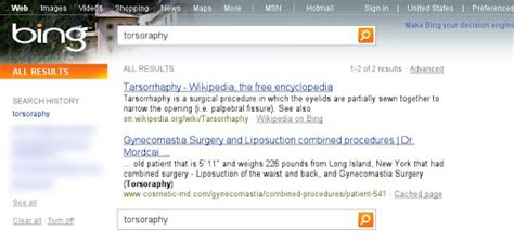 Search one site (like sfmoma.org ) or limit your results to a domain like.edu,.org or.gov. Official Google Blog: Microsoft's Bing uses Google search ...
