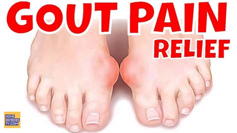 6 Natural Ways To Reduce Gout Pain Gout Attack Naturally Fast Gout