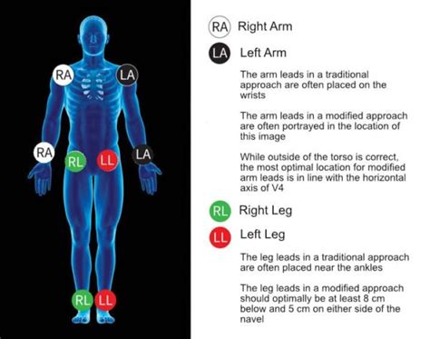 12 Performing A 12 Lead Ecg Nurse Your Own Way