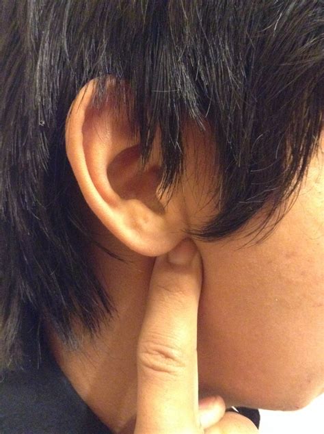 There Acupressure Point Under Your Ear To Cure Acne After