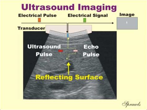 Ultrasounds About