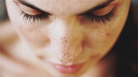 Does your skin have black marks? Dark Spots on Face: 11 Causes and 14 Natural Treatments