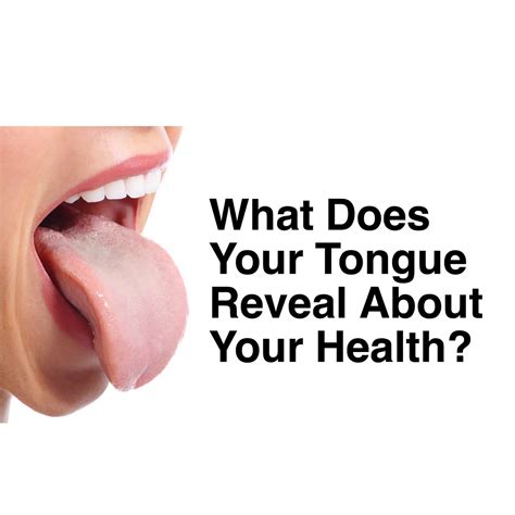 What Does Your Tongue Reveal About Your Health