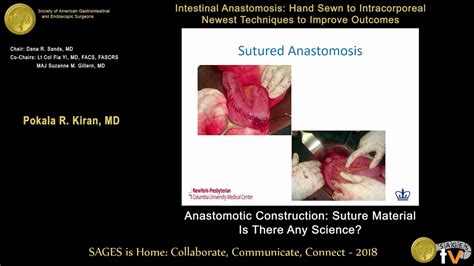 Anastomotic Construction Suture Material Is There Any Science Youtube