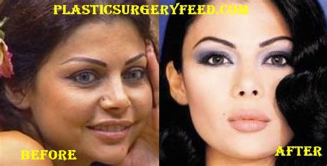 Haifa Wehbe Plastic Surgery Plastic Surgery Feed