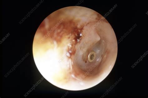 Human Outer Structure Of Ear