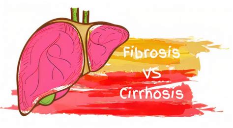 Whats The Difference Between Fibrosis Cirrhosis Page Of A Z Healthy