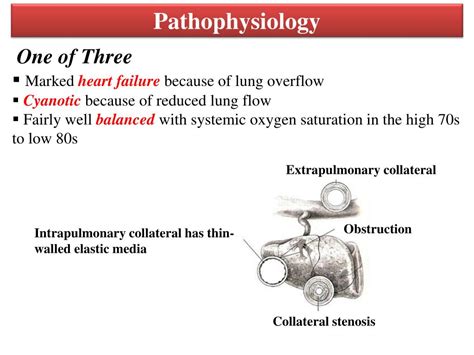 Related online courses on physioplus. PPT - Anatomy and pathophysiology of tetralogy of Fallot ...