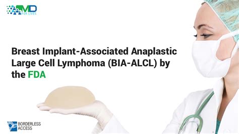 Breast Implant Associated Anaplastic Large Cell Lymphoma Bia Alcl By