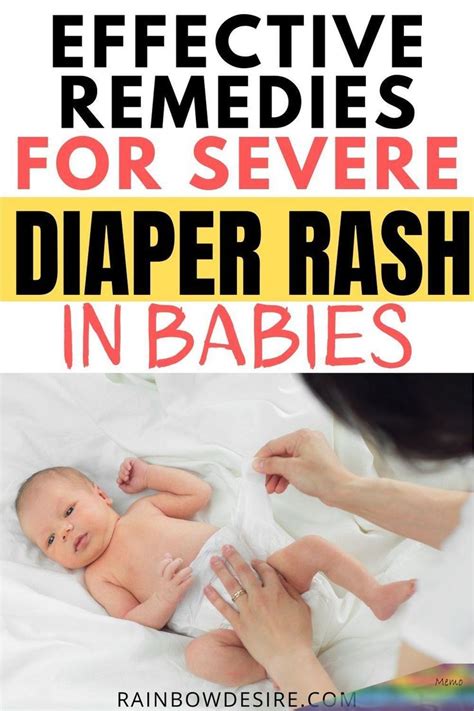Diaper Rash In Babies And Toddlers Babyrashestreatment Easy Home
