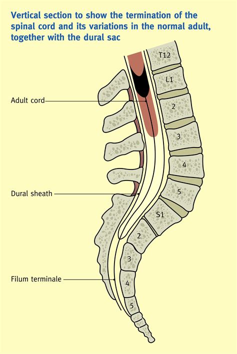 The Spinal Cord And Its Membranes Anaesthesia And Intensive Care Medicine