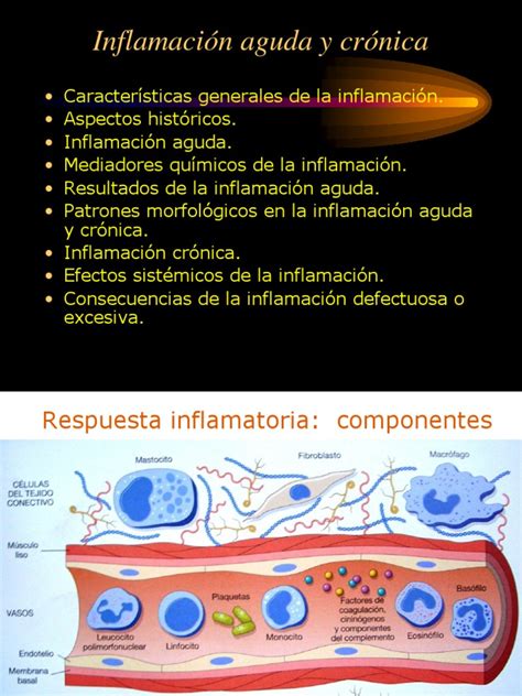 Inflamación Aguda Y Crónica Inflamación Sistema Inmune