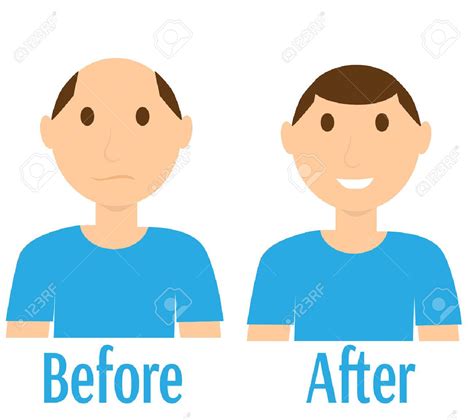 Before After Clipart 20 Free Cliparts Download Images On Clipground 2024