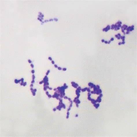 Streptococcus Diplococcus Pneumoniae Wm Microscope Slide