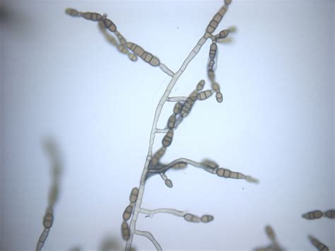 Fungus, which can be a cause of phaeohyphomycosis. MaxwellHandiseniPLPA631: Lab 2 Report
