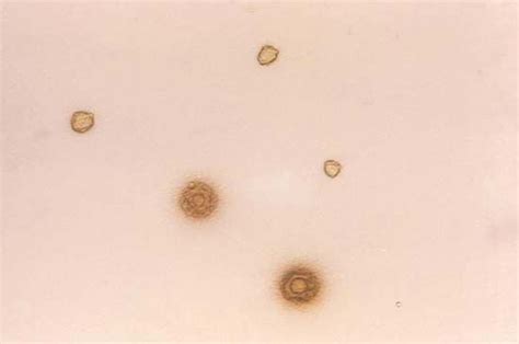 Mycoplasma Bacterium Genus Britannica