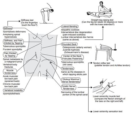 Approach To Low Back Pain Epomedicine