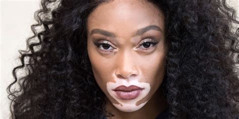 Real Talk With Winnie Harlow Moods Manuka And The