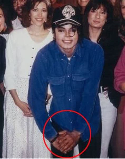 The Vitiligo Proof Michael Jackson Photo 32272000