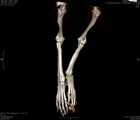 Bone Deformities Comparative Orthopaedic Research Laboratory