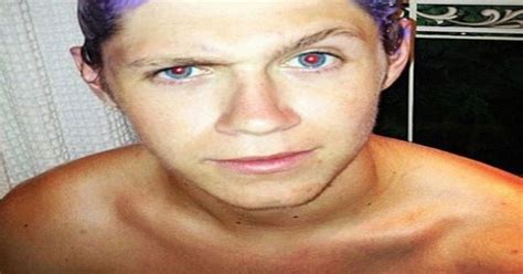Niall Horan Shocks One Direction Fans With Purple Hair Twitter Photo