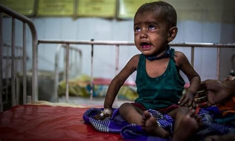 Number Of Malnourished People In India Declines To 2243 Million