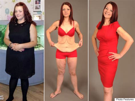 Bride Left With Excess Skin After Losing 9 Stone For Wedding Says