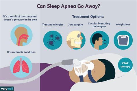 Does Sleep Apnea Go Away Risk Factors And Prognosis