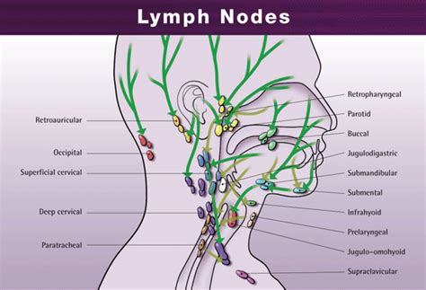 Seek medical advice if you think your swollen lymph nodes may have been caused by the serious physical trauma you experienced. Healing the Healer: A Naturopaths Journey to Heal and ...