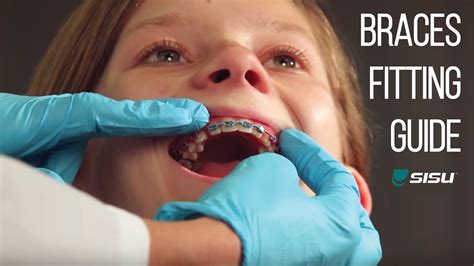 Molding the shock doctor gel max for a proper fit is the basic boil and bite setup. SISU Mouthguard | Braces Fitting Guide - YouTube