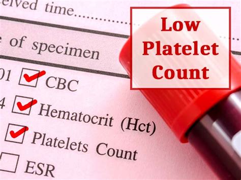 7 Natural Ways Of Increasing A Low Platelet Count