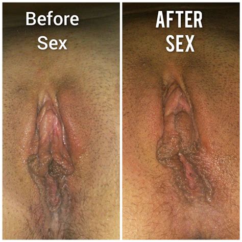 Pussy Comparison Before And After The Sex Porn Pic