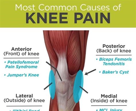 Knee Pain Common Causes Of Knee Pain