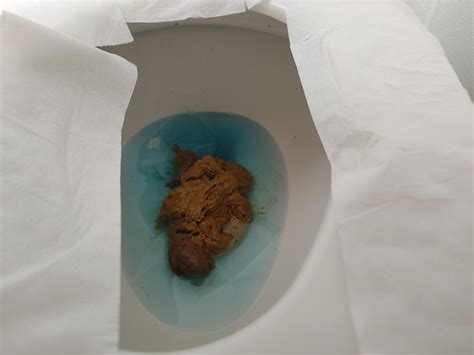 Thin Poop 42 Year Young Male 05 27 2020 Rpoop