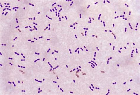 Image Gram Stain Streptococcus Pneumoniae Msd Manual Professional