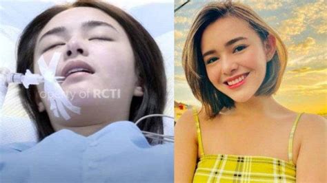 Update Kondisi Amanda Manopo Terungkap Penyakit Lawan Main Arya Saloka