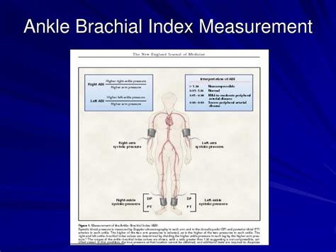 Ppt Ankle Brachial Index Measurement What Is It And Why Measure It