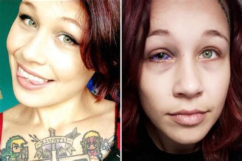 canadian model who had her eyeball tattooed might have to have it removed after it went horribly