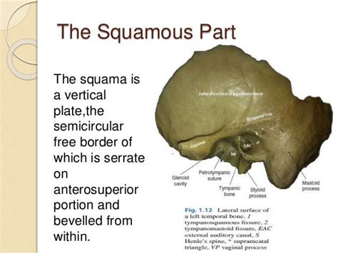 Anatomy of temporal bone By Dr.Vijay kumar , AMU