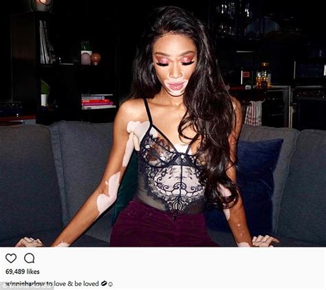Winnie Harlow Braless In A See Through Lace Bustier Daily Mail Online
