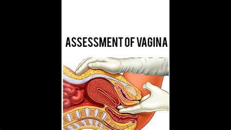 Vaginal Examination Youtube