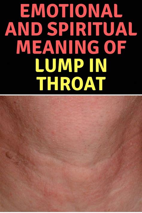 Do You Might Have A Lump In Your Neck Back Or Behind Your Ear This