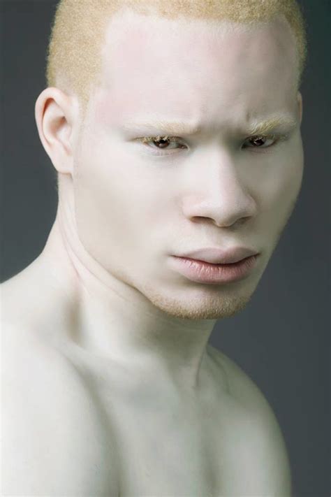 Albino Model Albino Actor Sir Maejor Flickr