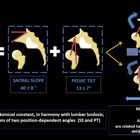 Spinopelvic Parameters A Global Sagittal Alignment And Spine