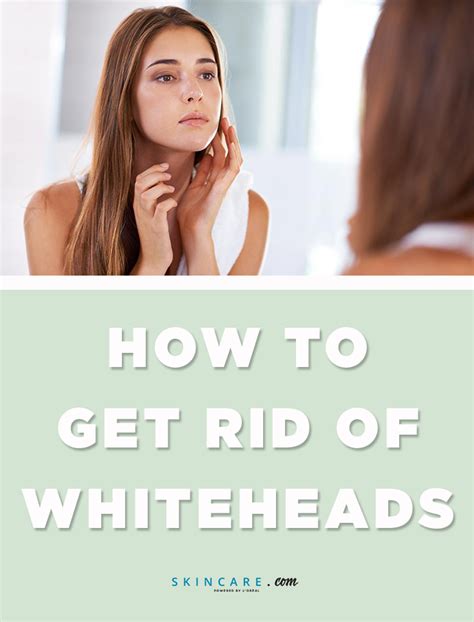 Whiteheads How To Get Rid Of Them Powered By Loréal